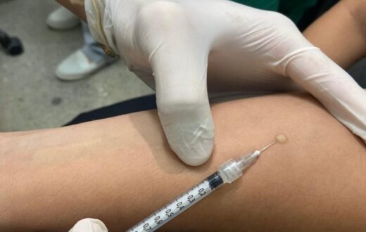 Tratamento preventivo da tuberculose é indicado após avaliação de infecção latente em Manaus